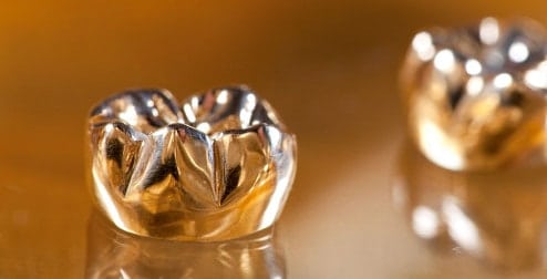Gold-Crown-for-back-teeth-(very-durable,-good-for-teeth-grinders)-They-have-largely-been-replaced-by-more-natural-looking-alternatives