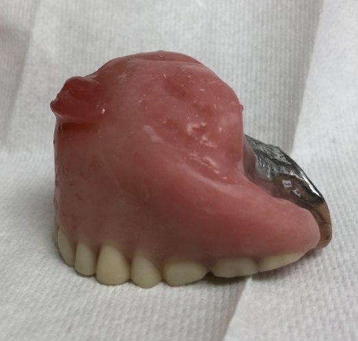 Obdurator Dental Maxillofacial Prosthodontist Virginia
