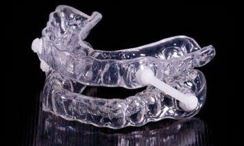Advanced Dentistry of Richmond Women owned and operated, patient focused dental Prosthodontics practice Dr. Clara Bergeron , Dr. Ursula Klostermyer