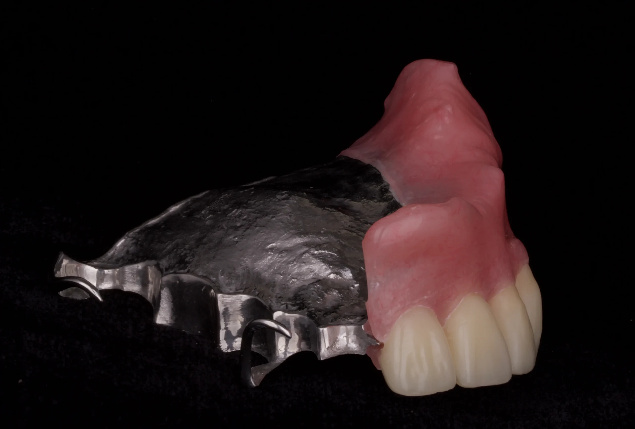 obturator Maxillofacial Prosthodontics Dental Specialist Richmond VA