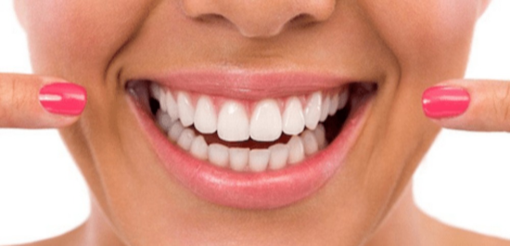 Teeth Whitening aesthetics happy smile Cosmetic procedures Advanced Dentistry of Richmond Women owned and operated, patient focused dental Prosthodontics practice