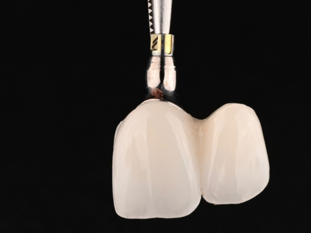Advanced Dental Implants