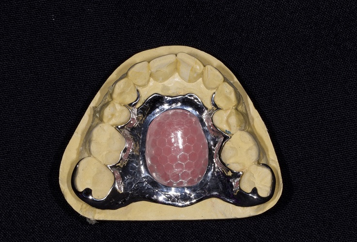 congenital obturator Maxillofacial prosthodontics Advanced Dentistry of Richmond Women owned and operated, dental practice, patient focused in Virginia